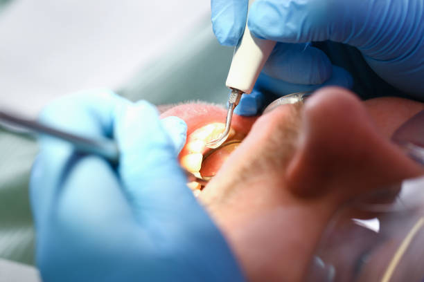 Best Cosmetic Emergency Dentistry in Mokena, IL