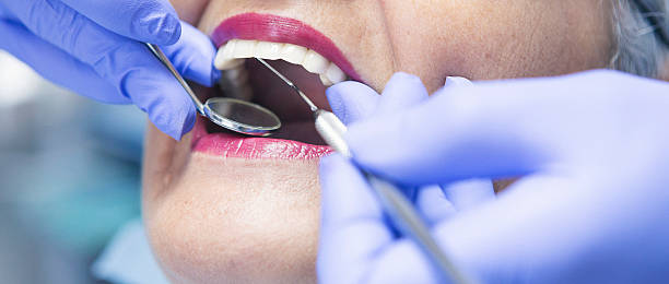 Best Emergency Wisdom Teeth Removal in Mokena, IL